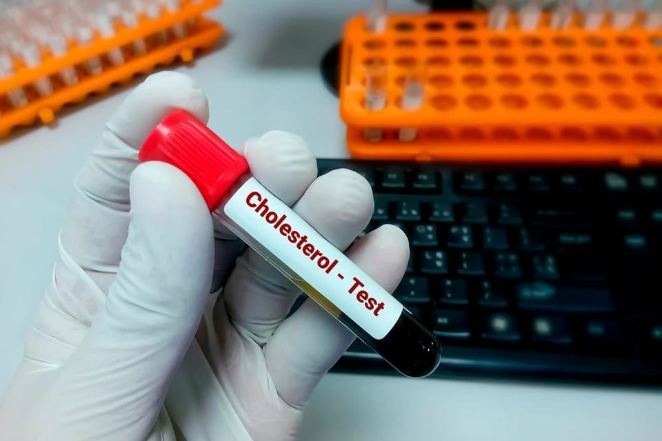 Private Cholesterol test in Pharmacy