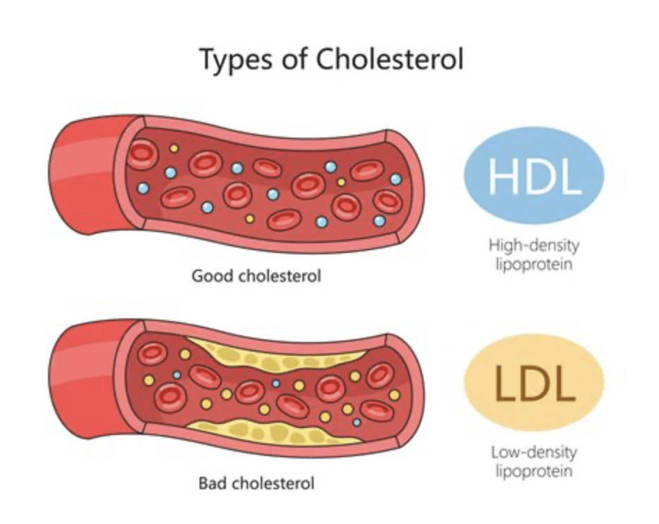 HDL and LDL Testing